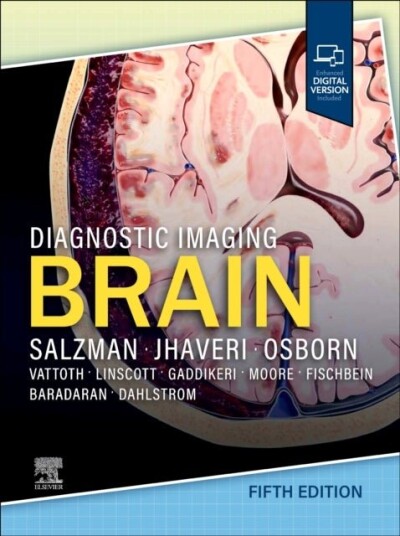 Diagnostic Imagin Brain