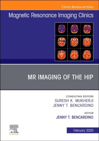 MR Imaging of the Hip, An Issue of Magnetic Resonance Imaging Clinics of North America