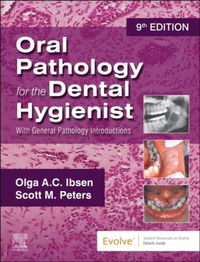 Oral Pathology for the Dental Hygienist: With General Pathology Introductions