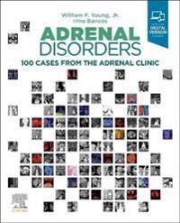 Adrenal Disorders Av William F. (Division Of Endocrinology Diabetes Metabolism And Nutrition Tyson Family Endocrinology Clinical Professor Young, Mayo
