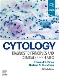 Cytology Av Edmund S. (Brigham And Women'S Hospital Department Of Pathology ) Cibas, Barbara S. Ducatman