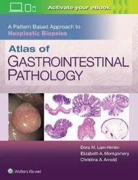 Atlas Of Gastrointestinal Pathology: A Pattern Based Approach To Neoplastic Biopsies Av Christina Arnold, Dora Lam-Himlin, Elizabeth A. Montgomery Atlas Of Gastrointestinal Pathology: A Pattern Based Approach To Neoplastic Biopsies Av Christina Arnold, Dora Lam-Himlin, Elizabeth A. Montgomery