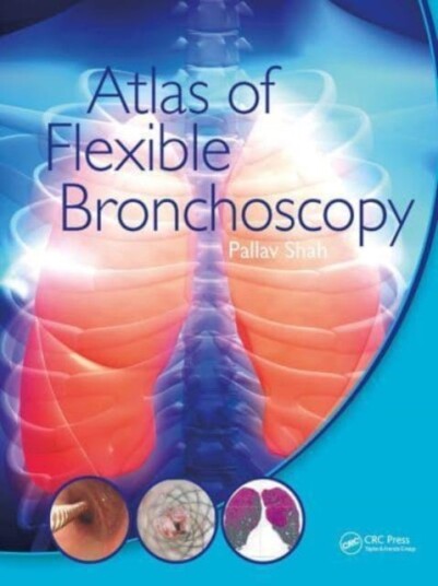 Atlas Of Flexible Bronchoscopy Av Pallav (Md Mbbs Frcp Consultant Physician Royal Brompton Hospital And Chelsea And Westminster Hospital London Uk) Sh