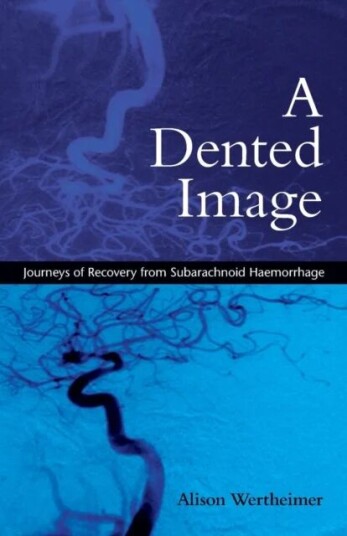 A Dented Image Av Alison (Freelance Writer Researcher And Counsellor Uk) Wertheimer
