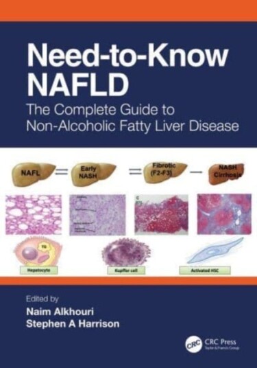 Need-To-Know Nafld