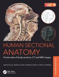 Human Sectional Anatomy Av Adrian Kendal Dixon, David J. (Abdominal Imaging Fellow Department Of Medical Imaging Sunnybrook Health Sciences Centre Tor