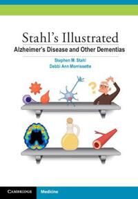 Stahl Stephen M. Stahl's Illustrated Alzheimer's Disease and Other Dementias