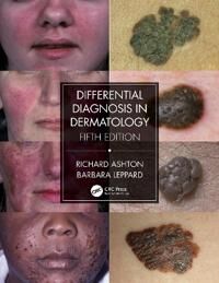 Differential Diagnosis In Dermatology Av Richard Ashton, Barbara Leppard