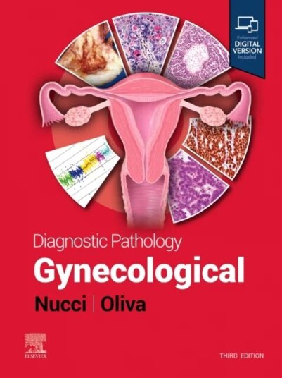 Diagnostic Pathology: Gynecological Av Marisa R. (Vice Chair And Director Women'S And Perinatal Pathology Department Of Pathology Brigham And Wom Diagnostic Pathology: Gynecological Av Marisa R. (Vice Chair And Director Women'S And Perinatal Pathology Department Of Pathology Brigham And Wom