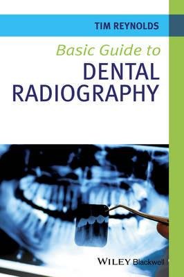 Basic Guide to Dental Radiography Basic Guide to Dental Radiography