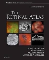 The Retinal Atlas Av K. Bailey (Clinical Professor Of Ophthalmology New York University School Of Medicine Freund, New York City Ny) Vitreous Retina M