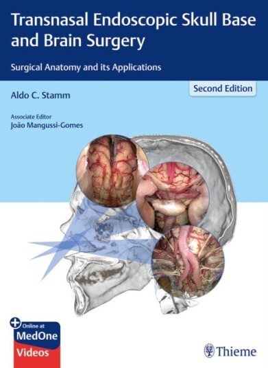 Transnasal Endoscopic Skull Base And Brain Surgery