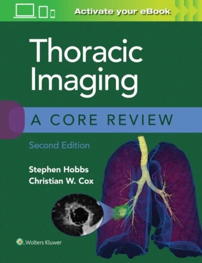 Thoracic Imaging: A Core Review Av Stephen Hobbs, Christian Cox