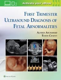 First Trimester Ultrasound Diagnosis Of Fetal Abnormalities Av Alfred Z. Abuhamad, Rabih Chaoui First Trimester Ultrasound Diagnosis Of Fetal Abnormalities Av Alfred Z. Abuhamad, Rabih Chaoui