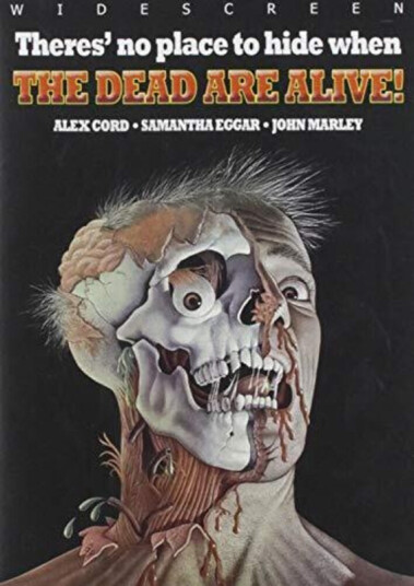 Dead Are Alive DVD