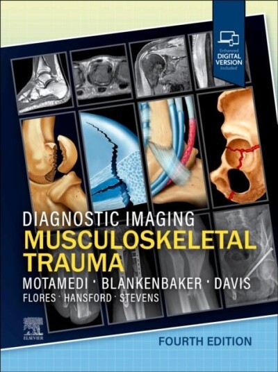 Diagnostic Imagin Musculoskeletal Trauma