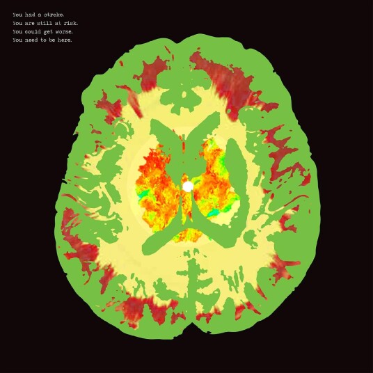 The Minus 5  Stroke Manor  LP/Vinyl