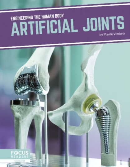 Engineering the Human Body: Artificial Joints Engineering the Human Body: Artificial Joints