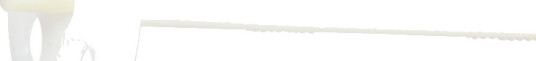 Essve Isolasjonsplugg 10x130mm for Betong og Lettbetong, 250 stk Essve Isolasjonsplugg 10x130mm for Betong og Lettbetong, 250 stk