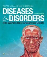 Diseases & Disorders Av Anatomical Chart Company