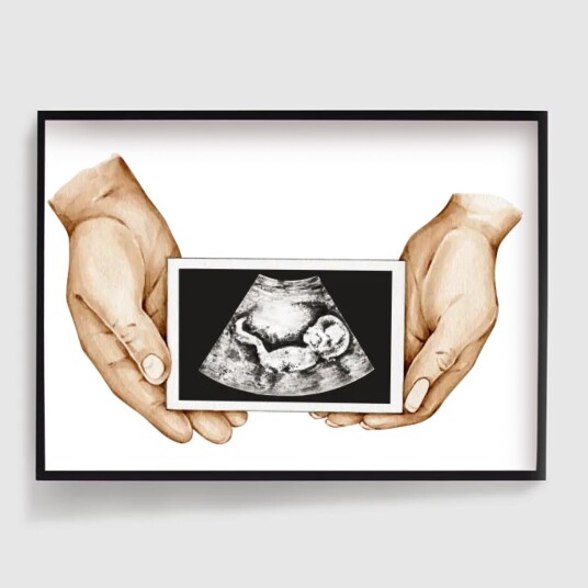 Personlig Plakat Hender som Holder Sonogram