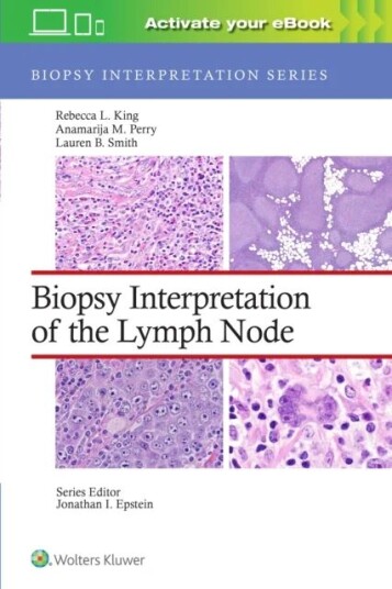 Biopsy Interpretation Of The Lymph Node Av Rebecca Leigh Md King, Anamarija M. Md Perry, Lauren B. Smith