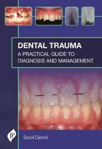Dental Trauma Av Serpil Djemal