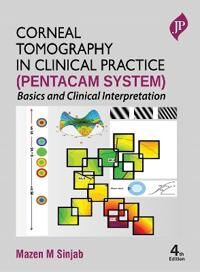 Corneal Tomography In Clinical Practice (Pentacam System) Av Mazen M Sinjab