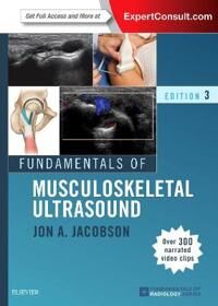 Fundamentals Of Musculoskeletal Ultrasound Av Jon A. (Associate Professor Of Radiology Jacobson, Division Of Musculoskeletal Radiology University Of M