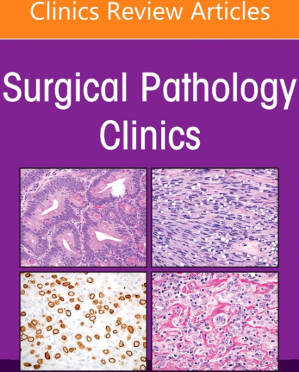Updates in Gynecologic Pathology, An Issue of Surgical Pathology Clinics Updates in Gynecologic Pathology, An Issue of Surgical Pathology Clinics