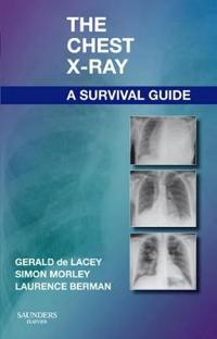The Chest X-Ray: A Survival Guide Av Gerald Ma Frcr (Consultant Radiologist To Www.Radiology-Courses.Com And Formerly Consultant Radiologist At Northw