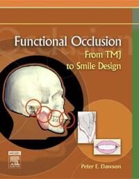 Functional Occlusion Av Peter E. Dawson