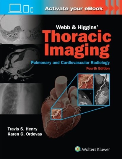 Webb & Higgins Thoracic Imagin Print + eBook with Multimedia