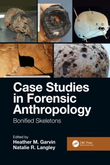 Case Studies in Forensic Anthropology  Bonified Skeletons