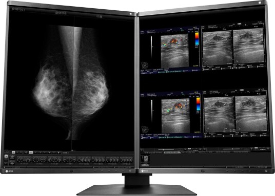 EIZO RX560-MD Matched for MammoDuo Solution