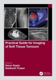 Practical Guide For Imaging Of Soft Tissue Tumours