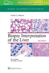 Biopsy Interpretation Of The Liver Av Michael Md Torbenson