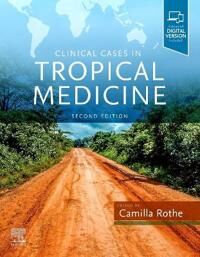 Clinical Cases In Tropical Medicine Av Camilla (Head Of Clinical Tropical Medicine Division Of Infectious Diseases And Tropical Medicine Lmu Universit