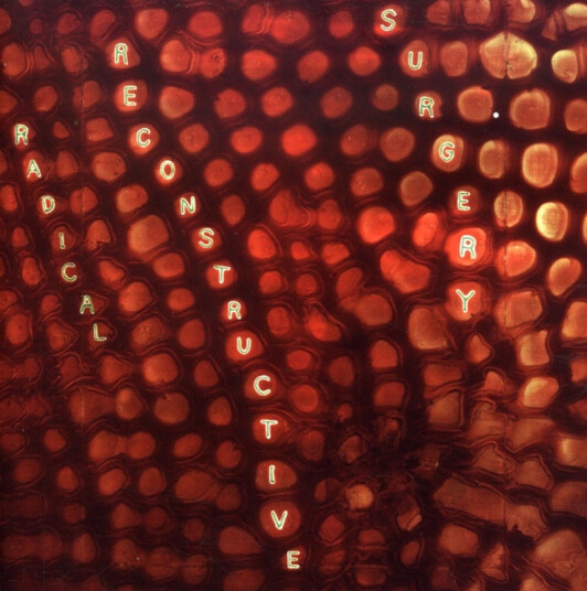 Scotty Hard Scotty Hard's Radical Reconstructive Surgery CD