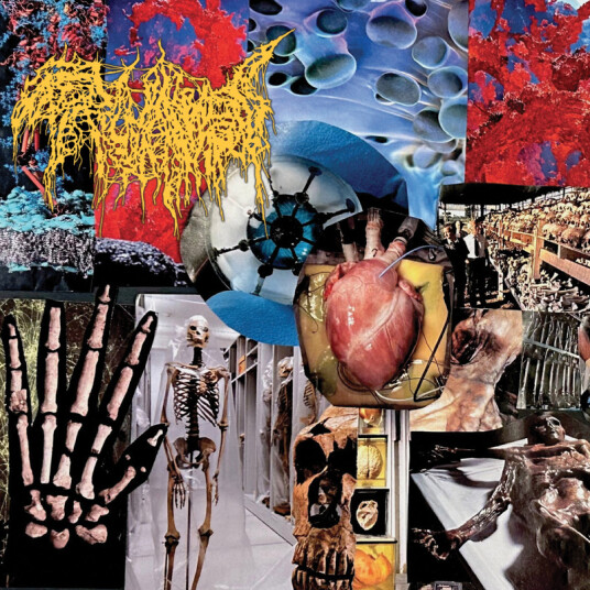 Trichomoniasis Harvest Of The Killing Fields CD