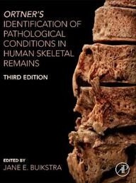 Ortner'S Identification Of Pathological Conditions In Human Skeletal Remains Ortner'S Identification Of Pathological Conditions In Human Skeletal Remains