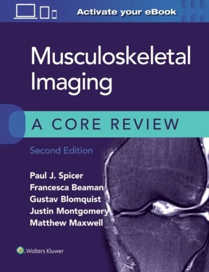 Musculoskeletal Imaging: A Core Review Av Paul Spicer, Francesca Beaman, Gustav Blomquist, Justin Montgomery, Matthew Maxwell