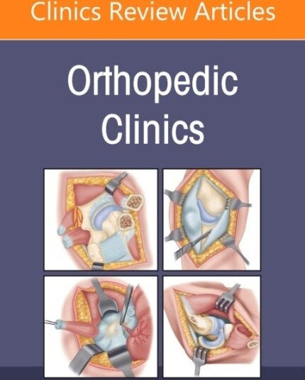 Minimally Invasive Surgery, An Issue of Orthopedic Clinics