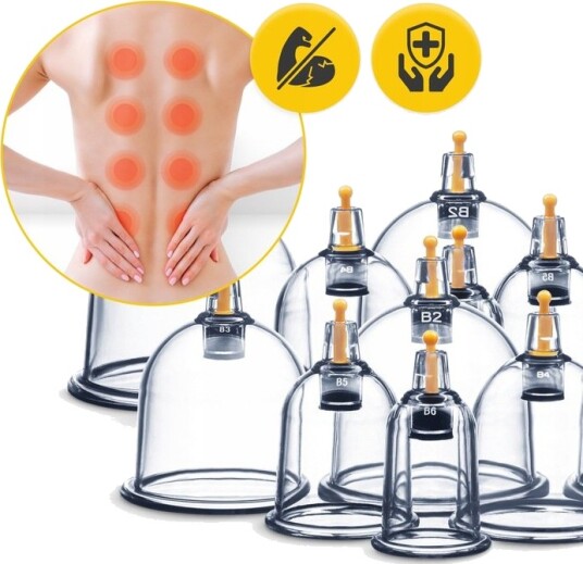 Kinesiske vakuum kopper 12 stk + pumpe | Smertelindring massasje avslapning
