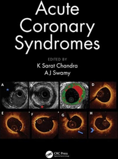 Acute Coronary Syndromes
