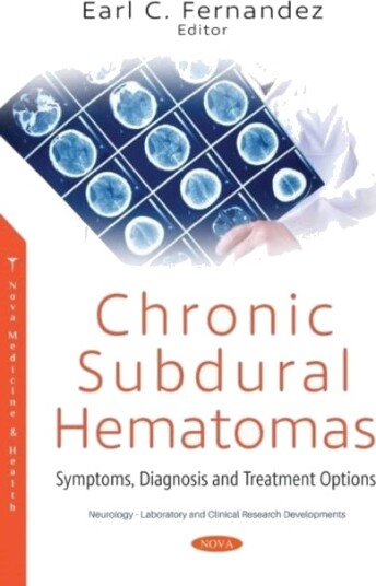 Chronic Subdural Hematomas