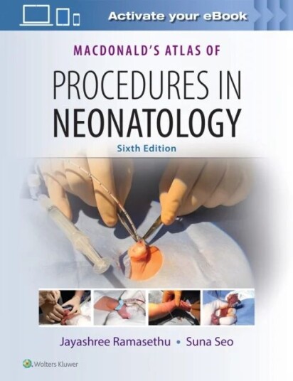 Macdonald'S Atlas Of Procedures In Neonatology