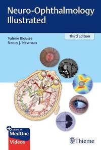 Neuro-Ophthalmology Illustrated Av Valerie Biousse, Nancy Newman