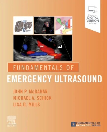 Fundamentals Of Emergency Ultrasound Av John P. (Department Of Radiology University Of California Davis Health System Sacramento California) Mcgahan,