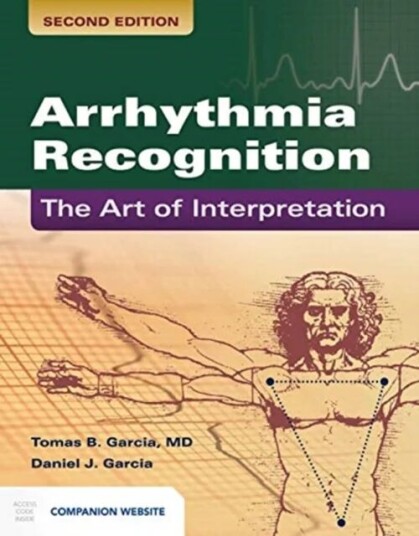 Arrhythmia Recognition: The Art Of Interpretation Av Tomas B. Garcia, Daniel J. Garcia